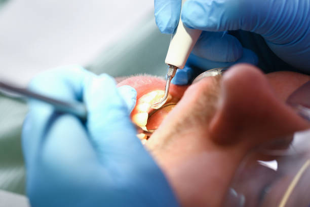 Best Emergency Dental Surgery in Thruston, KY