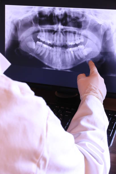 Best Emergency Tooth Extraction in Thruston, KY
