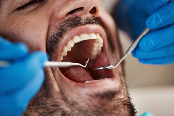Best Walk-In Emergency Dentist in Thruston, KY
